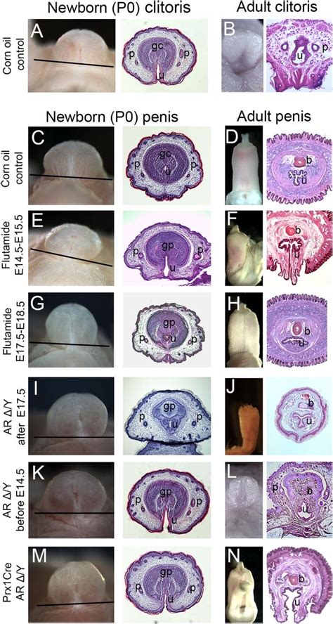 Effect of penile.